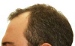 Hair Treatment