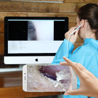 Visual Earwax Clean Tool